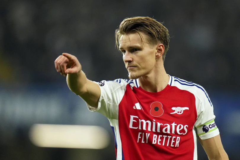 Strategi Unik Arsenal Untuk Tutupi Cedera Martin Odegaard